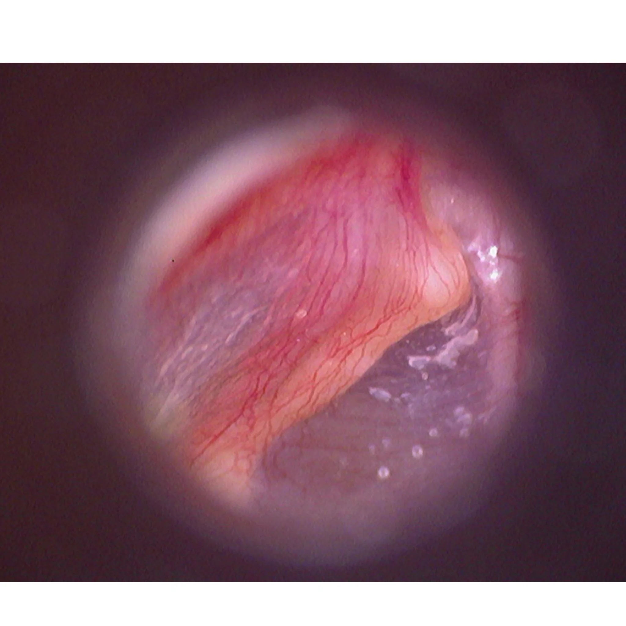 Firefly DE500 Video Otoscope - Image 4