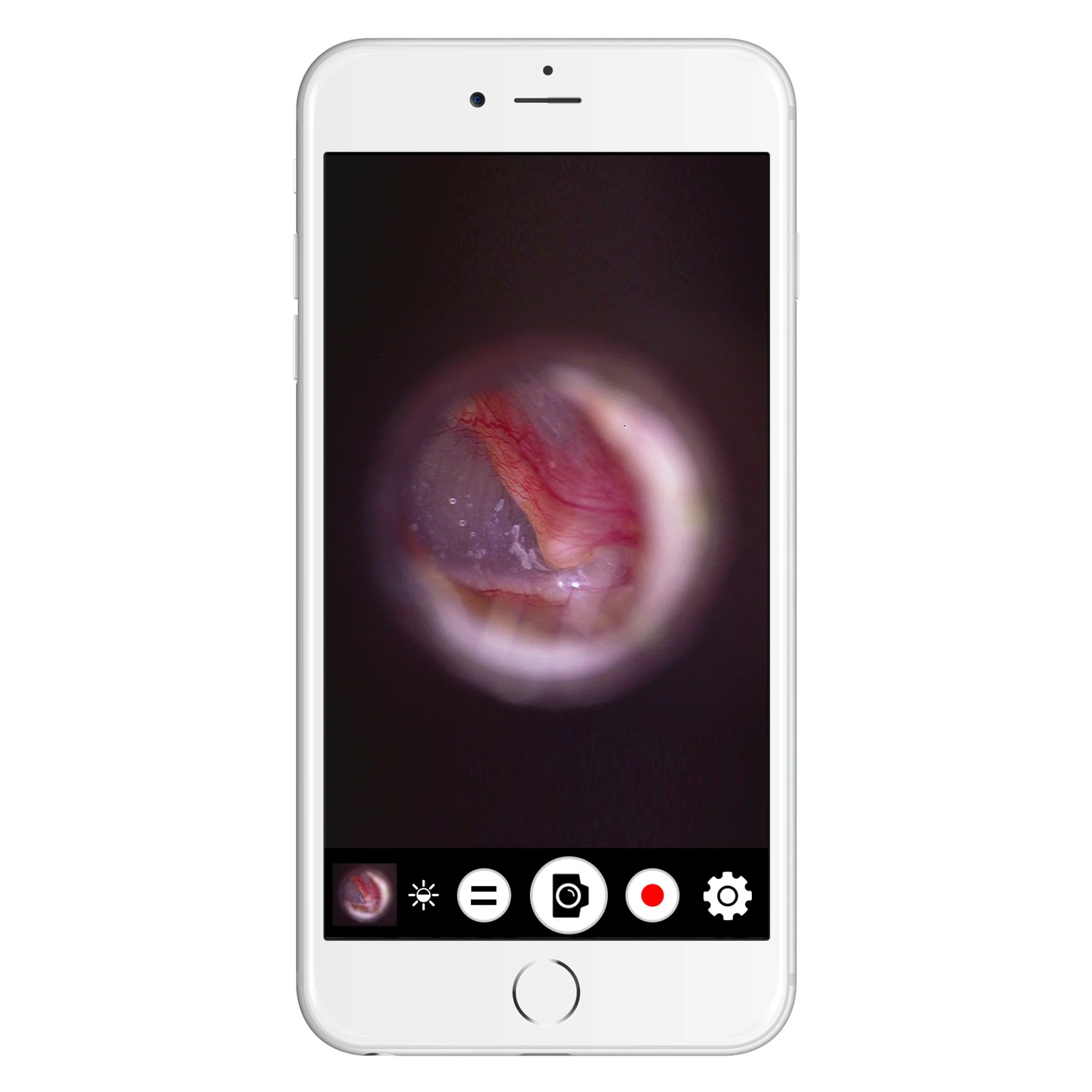 Firefly DE570 HD Wireless Mobile Video Otoscope - Image 2