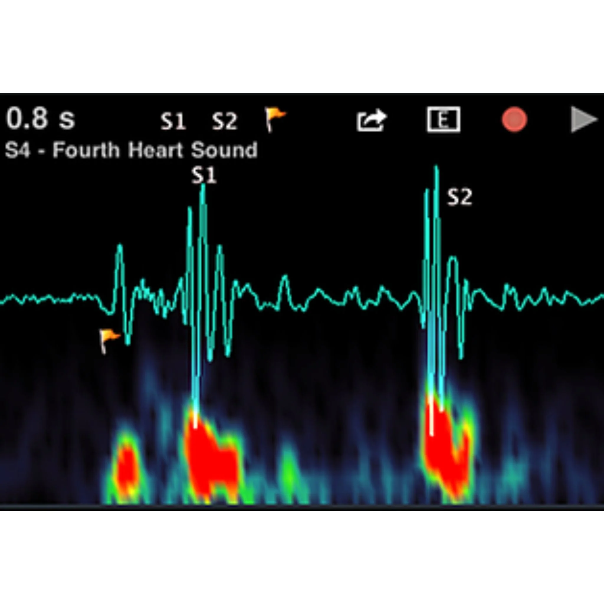 Thinklabs One Stethoscope - Image 5